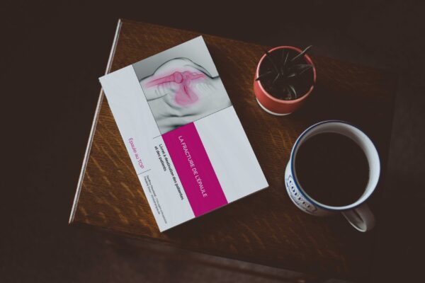 Fracture de l'épaule