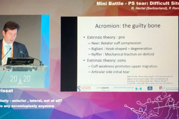 conflit sous-acromial