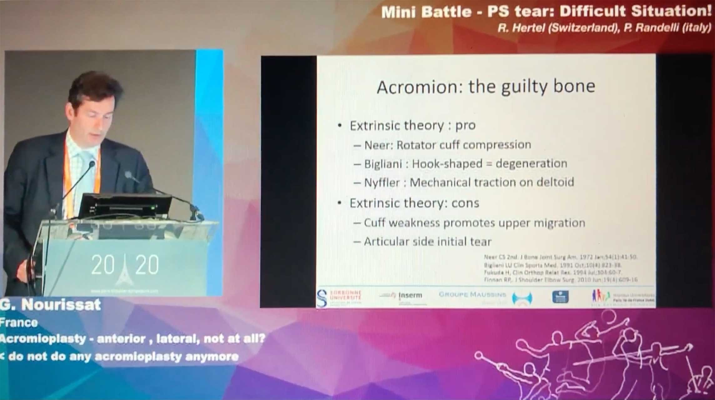 conflit sous-acromial