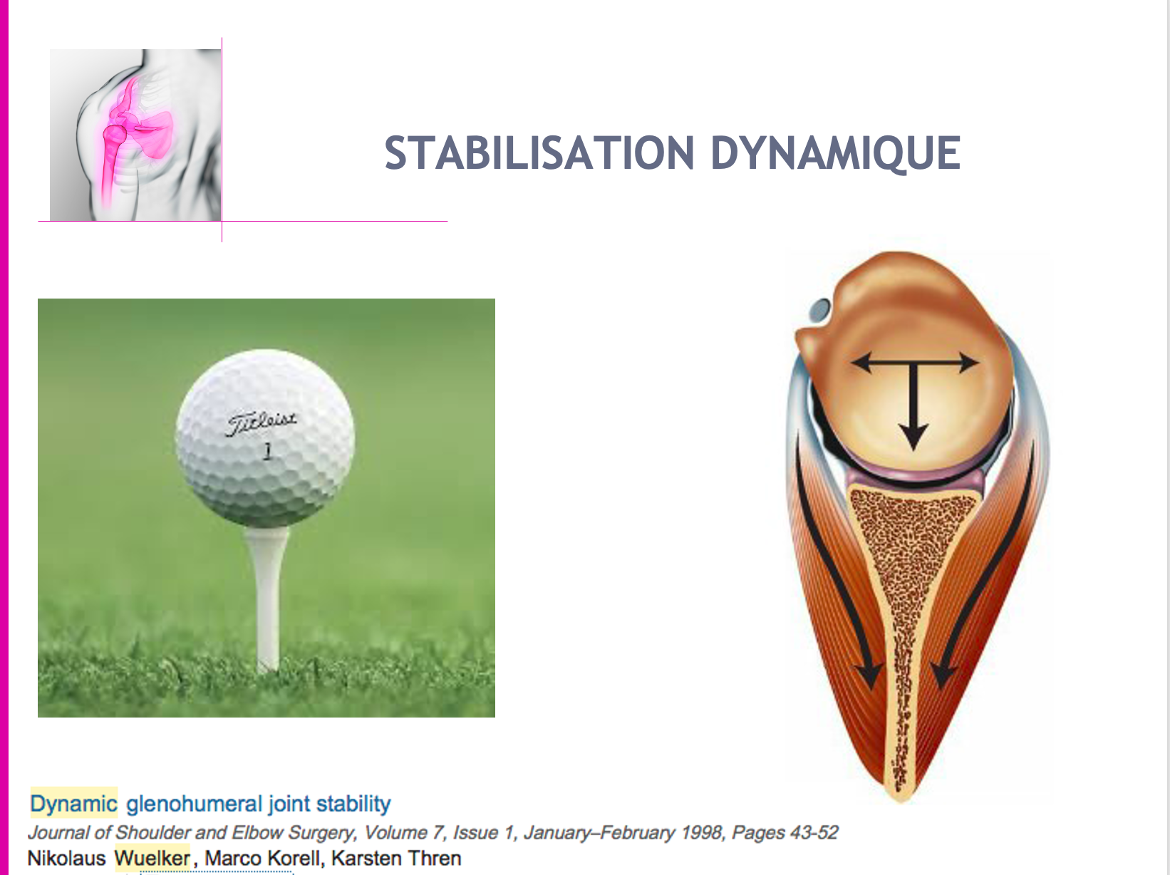 L'INSTABILITÉ ANTÉRIEURE DE L'EPAULE - L'épaule au TOP