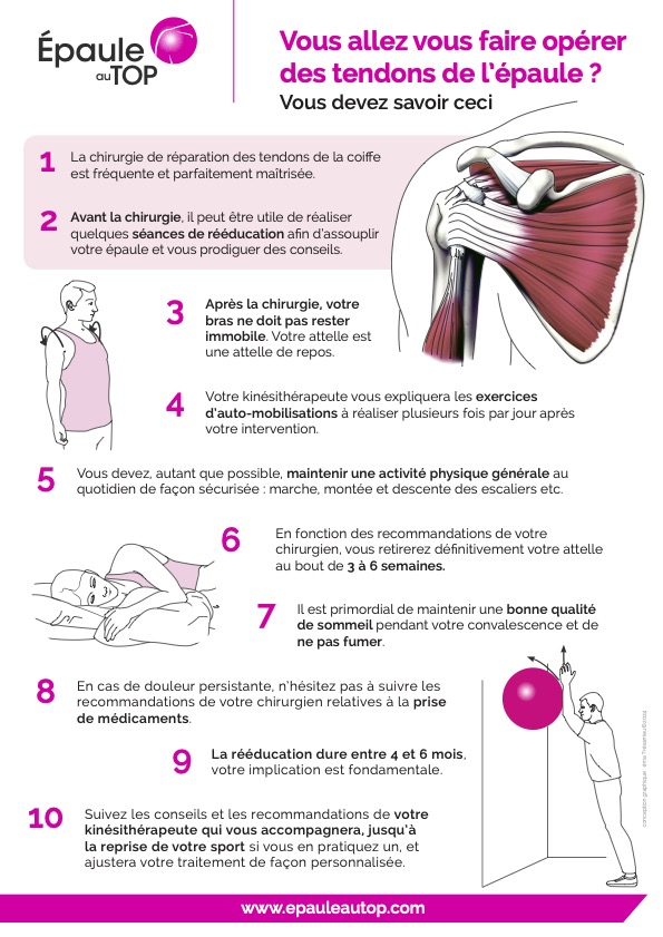 Vous allez vous faire opérer des tendons de l’épaule ? Vous devez savoir ceci